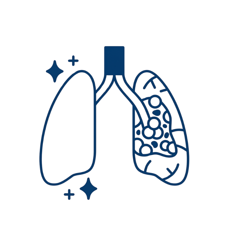 Lung Abscess